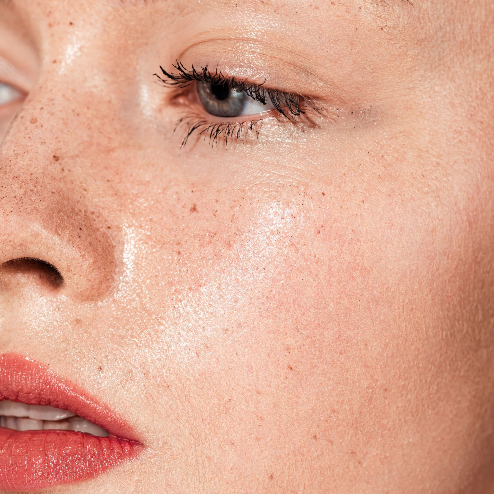 A closeup of a woman’s face after a dermaplaning treatment